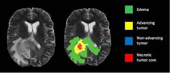 Screenshot of  web app